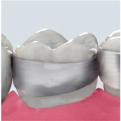 MLR Band Std Contoured Reg ME U Lt 1Molar 31