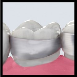 MLR Band Std Contoured Reg ME U Lt 1Molar 43+