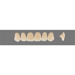 Vita Vitapan 3D, Upper Anterior, Shade 3L15, Mould Z61