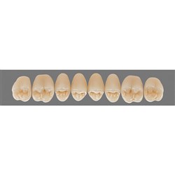 Vita Lingoform 3D, Upper, Posterior, Shade 2L15 B2, Mould 24