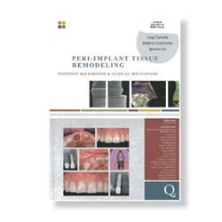 Peri-Implant Tissue Remodeling Scientific Background & Clinic