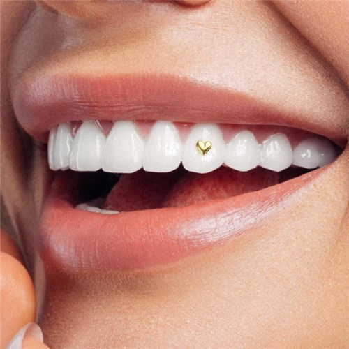 102-Large_heart-tooth-gem-twinkles-dental-jewelry_in_smile_600x
