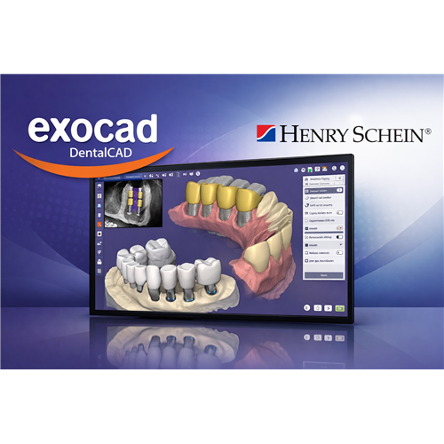 E1-BD80003LP01 Exocad DentalCAD Ultimate Lab Bundle Perpetual