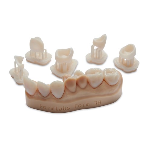 Permanent Crown A2 Resin