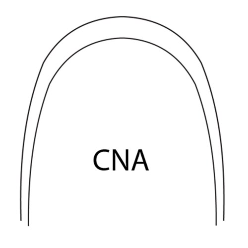 NAOL 017X025 Upper Beta Titanium Cna Proform Wire - 5