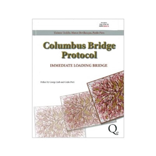 Columbus Bridge Protocol - Immediate Loading Bridge