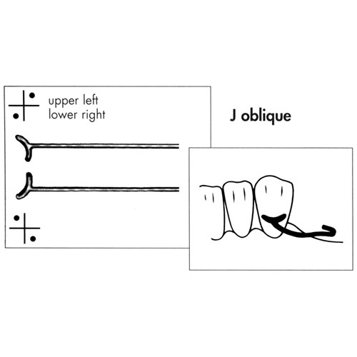 Scheu J Oblique Clasp - 1mm, 10-Pack