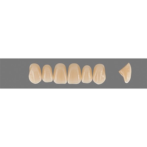 2R2.5 Upper T44 Anterior